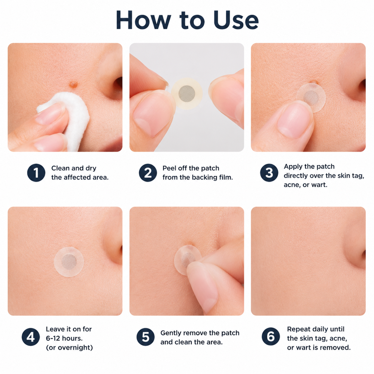 Curalona® 2-in-1 Microneedle & Hydrocolloid Patch (Removes Raised Moles, Acne, Flat Warts & Skin Tags | Helps Improve Wrinkles, Scars & Blemishes | Invisible Patches for Face & Body)