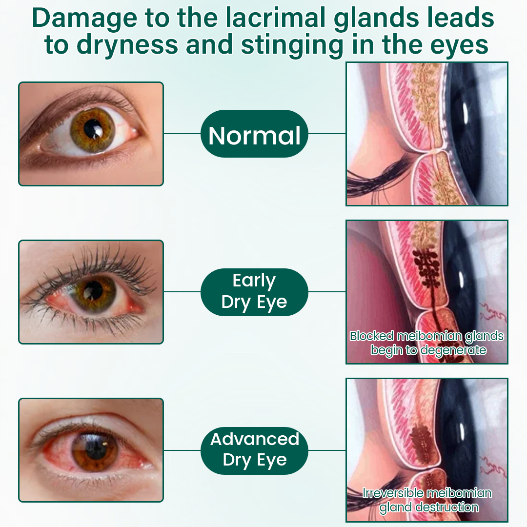 OptiClear® Nano Eye Roller Serum