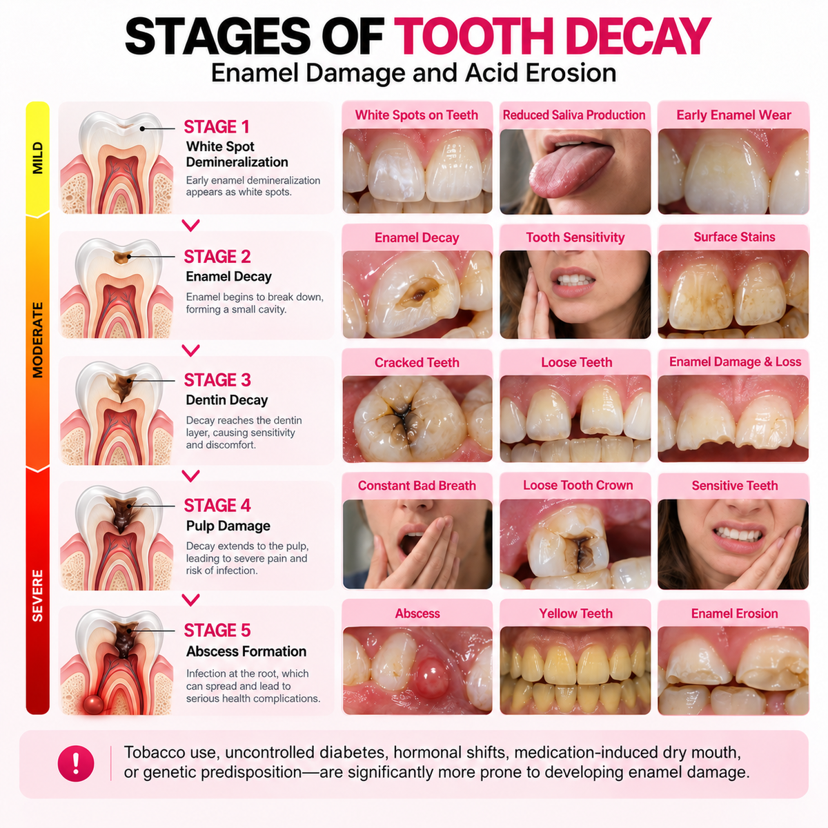 DenPerm® Cavity-Repair Natural Enamel Filling Gel