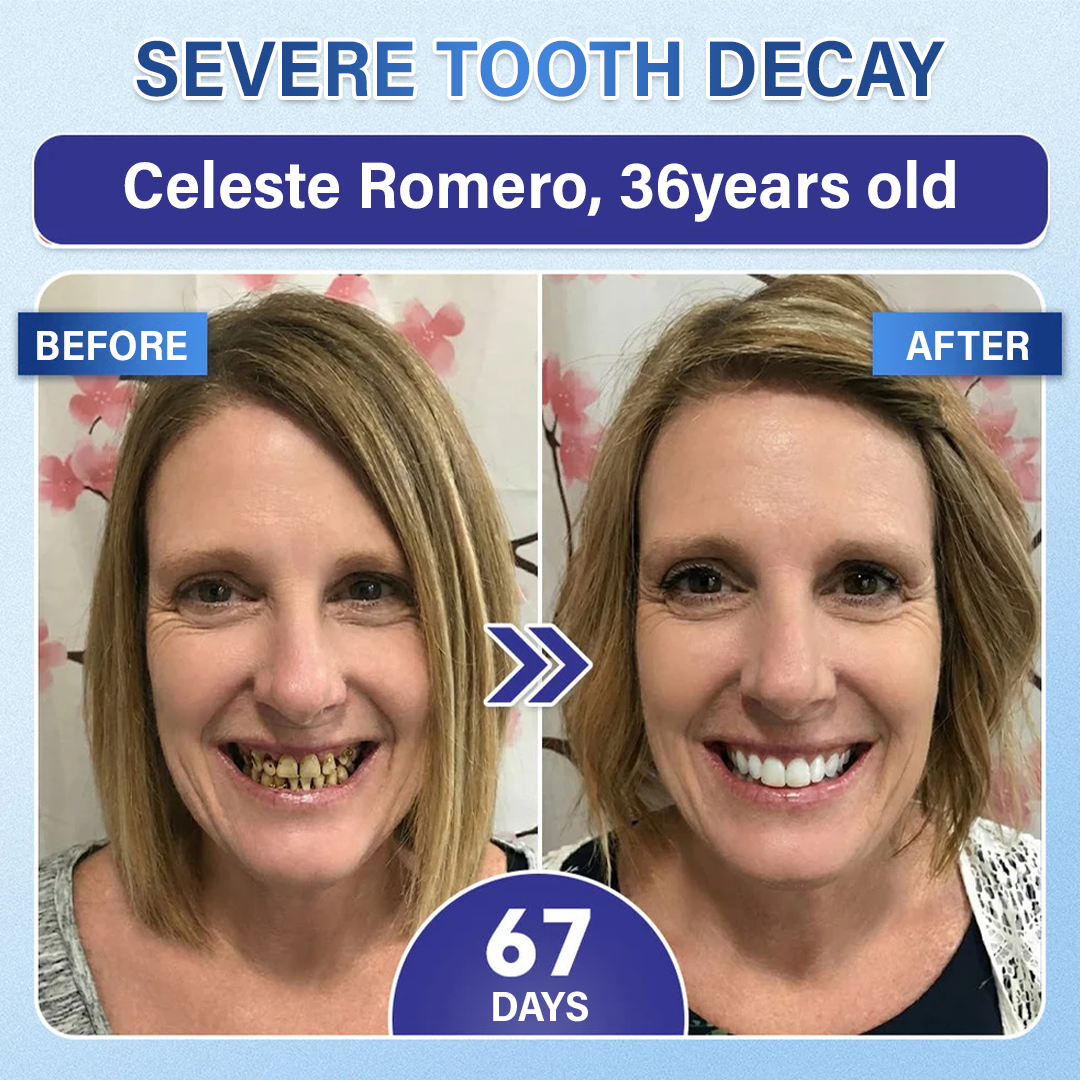 Ceoerty® Tooth & Gum Repair Fast-Dissolving Microneedle Patch