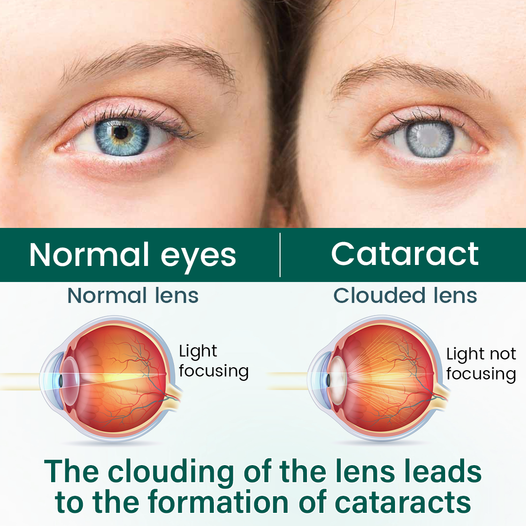 OptiClear® Nano Eye Roller Serum