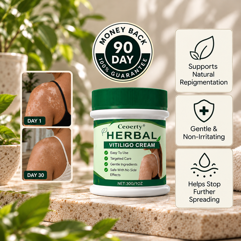 Ceoerty® Herbal Vitiligo Cream