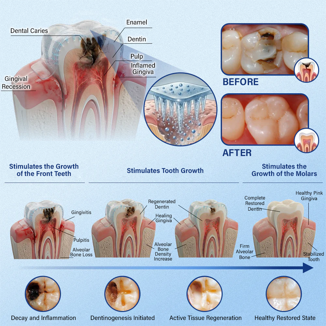 Ceoerty® Tooth & Gum Repair Fast-Dissolving Microneedle Patch