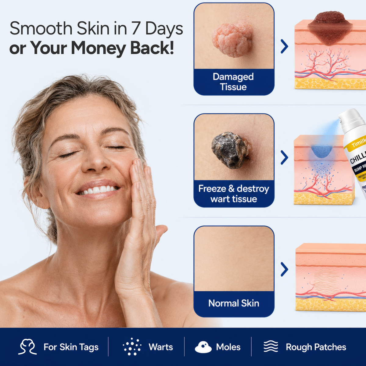 ChillErase® Overnight Skin Tag Spray