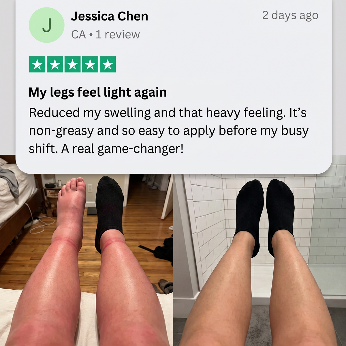 Timilk® Professional Leg Circulation Cream