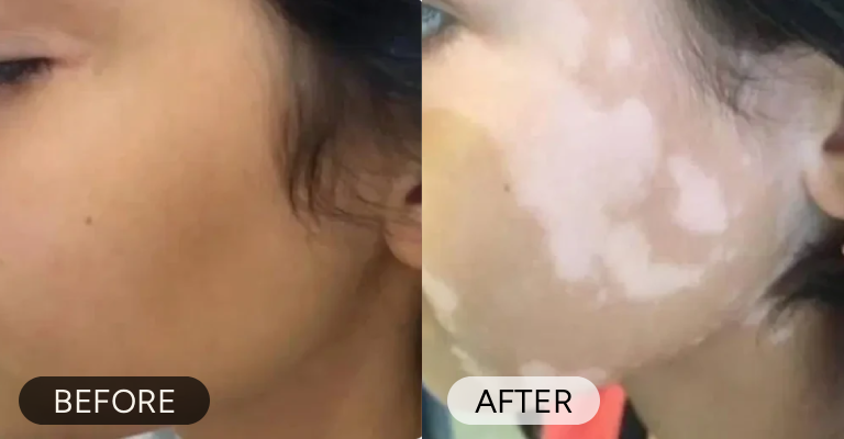 Customer before and after result