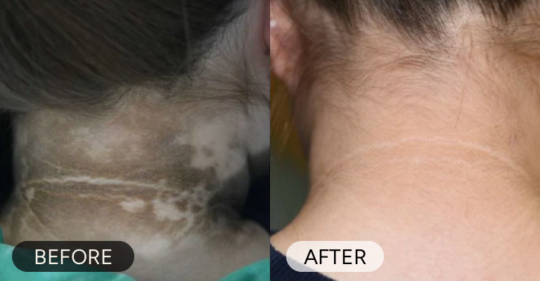Customer before and after result