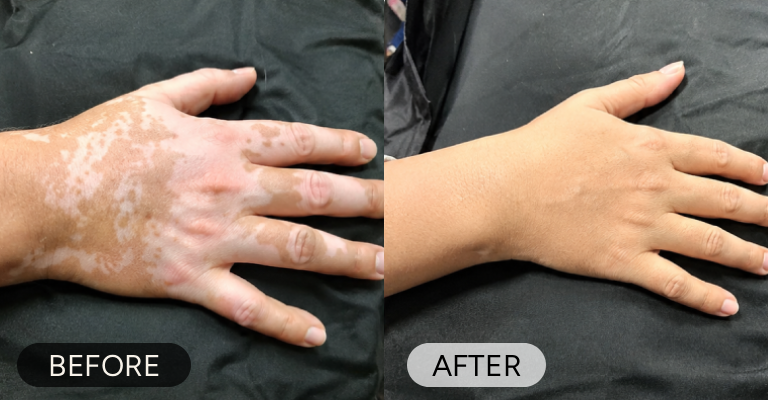 Customer before and after result