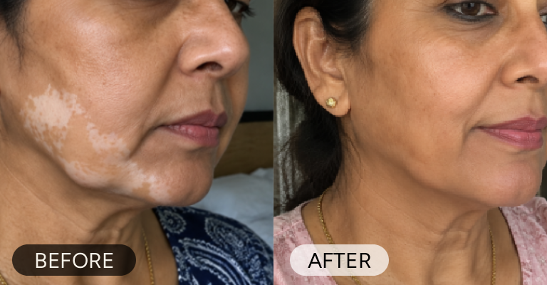 Customer before and after result