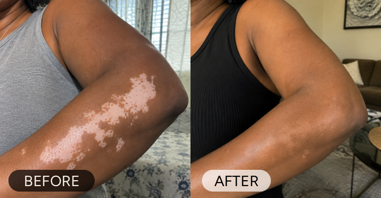 Customer before and after result